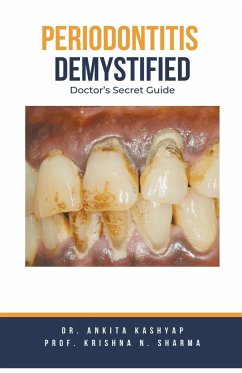 Periodontitis Demystified - Kashyap, Ankita; Sharma, Krishna N.