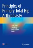 Principles of Primary Total Hip Arthroplasty
