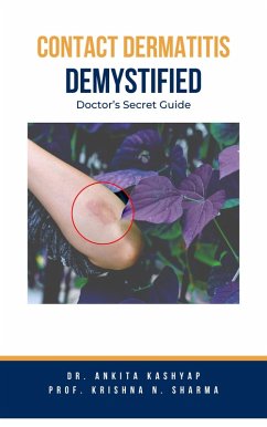 Contact Dermatitis Demystified: Doctor's Secret Guide (eBook, ePUB) - Kashyap, Ankita; Sharma, Krishna N.