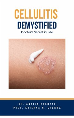 Cellulitis Demystified: Doctor's Secret Guide (eBook, ePUB) - Kashyap, Ankita; Sharma, Krishna N.