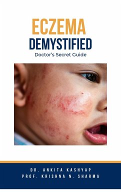 Eczema Demystified: Doctor's Secret Guide (eBook, ePUB) - Kashyap, Ankita; Sharma, Krishna N.