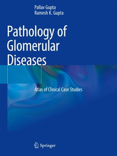 Pathology of Glomerular Diseases - Gupta, Pallav;Gupta, Ramesh K.