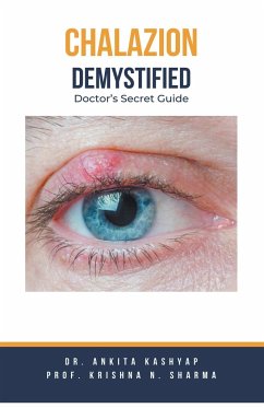 Chalazion Demystified - Kashyap, Ankita; Sharma, Krishna N.