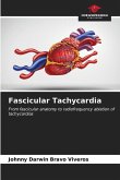 Fascicular Tachycardia