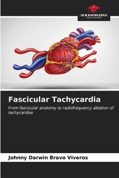 Fascicular Tachycardia - Bravo Viveros, Johnny Darwin