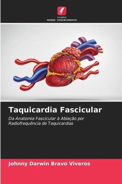 Taquicardia Fascicular - Bravo Viveros, Johnny Darwin