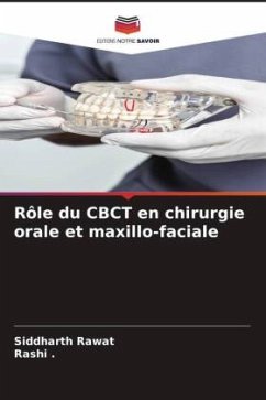 Rôle du CBCT en chirurgie orale et maxillo-faciale - Rawat, Siddharth;., Rashi