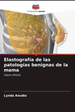 Elastografía de las patologías benignas de la mama - Aoudia, Lynda