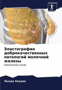 Cover Jelastografiq dobrokachestwennyh patologij molochnoj zhelezy