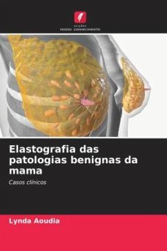 Elastografia das patologias benignas da mama - Aoudia, Lynda