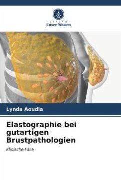 Elastographie bei gutartigen Brustpathologien - Aoudia, Lynda