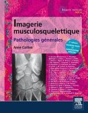 Imagerie Musculosquelettique: Pathologies Générales