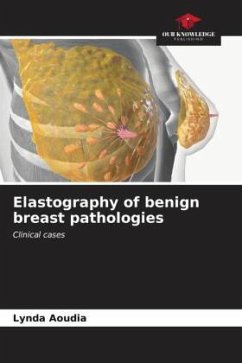 Elastography of benign breast pathologies - Aoudia, Lynda