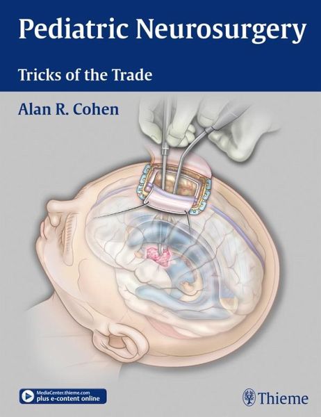 Pediatric Neurosurgery: Tricks of the Trade (eBook, ePUB) Pediatric Neurosurgery: Tricks of the Trade (eBook, ePUB)