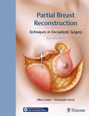 Partial Breast Reconstruction (eBook, ePUB)