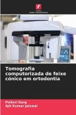 Tomografia computorizada de feixe cónico em ortodontia