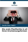 Die orale Planflechte in all ihren Erscheinungsformen