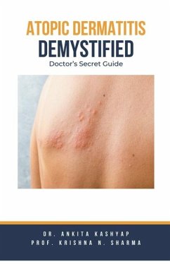 Atopic Dermatitis Demystified - Kashyap, Ankita; Sharma, Krishna N