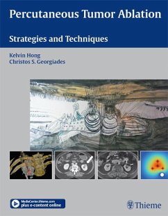 Cover Percutaneous Tumor Ablation (eBook, ePUB)