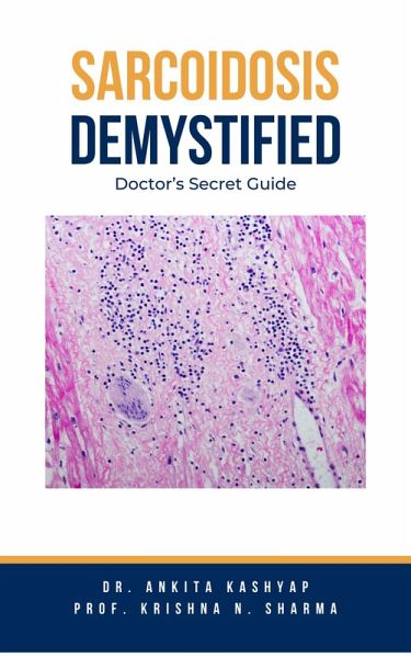 Sarcoidosis Demystified: Doctor's Secret Guide (eBook, ePUB)