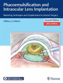 Phacoemulsification and Intraocular Lens Implantation (eBook, ePUB)