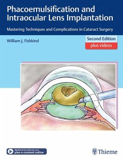 Phacoemulsification and Intraocular Lens Implantation (eBook, ePUB) - Fishkind, William J.