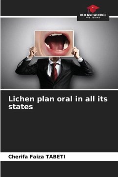 Cover Lichen plan oral in all its states