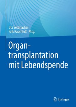 Organtransplantation mit Lebendspende (eBook, PDF)