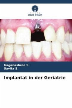 Implantat in der Geriatrie - S., Gaganashree;S., Savita