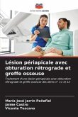 Lésion périapicale avec obturation rétrograde et greffe osseuse