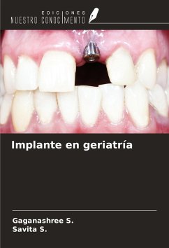 Cover Implante en geriatría