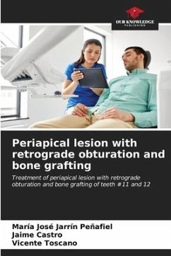 Periapical lesion with retrograde obturation and bone grafting - Jarrín Peñafiel, María José;Castro, Jaime;Toscano, Vicente