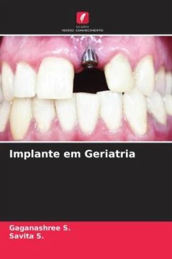 Implante em Geriatria - S., Gaganashree;S., Savita