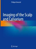 Imaging of the Scalp and Calvarium