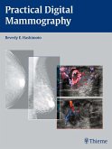 Practical Digital Mammography (eBook, ePUB)