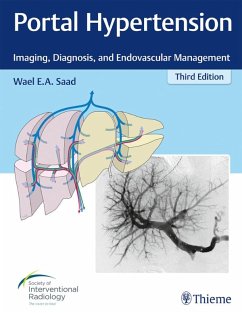 Portal Hypertension (eBook, ePUB) - Saad, Wael E. A.