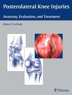 Posterolateral Knee Injuries (eBook, ePUB) - Laprade, Robert F.