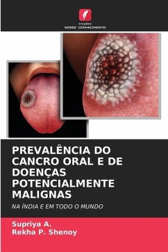 PREVALÊNCIA DO CANCRO ORAL E DE DOENÇAS POTENCIALMENTE MALIGNAS - A., Supriya;Shenoy, Rekha P.