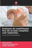 Evolução da reabilitação fixa da arcada completa com implantes