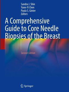 A Comprehensive Guide to Core Needle Biopsies of the Breast