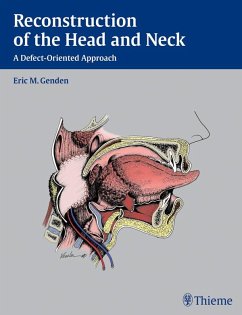 Reconstruction of the Head and Neck (eBook, ePUB) - Genden, Eric M.
