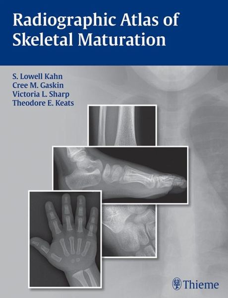 Radiographic Atlas of Skeletal Maturation (eBook, ePUB) Radiographic Atlas of Skeletal Maturation (eBook, ePUB)