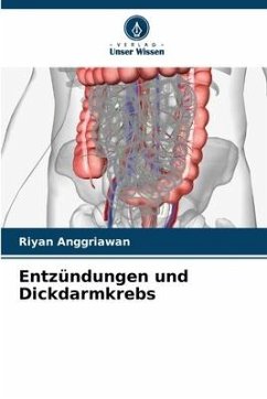 Entzündungen und Dickdarmkrebs - Anggriawan, Riyan
