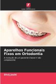 Aparelhos Funcionais Fixos em Ortodontia