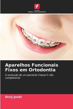 Aparelhos Funcionais Fixos em Ortodontia - Joshi, Divij