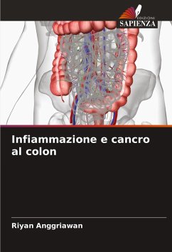 Cover Infiammazione e cancro al colon