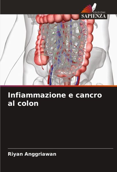 Infiammazione e cancro al colon Infiammazione e cancro al colon