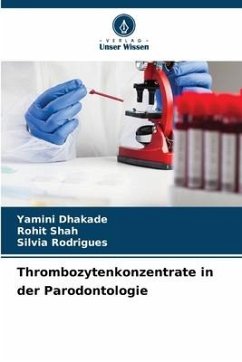 Thrombozytenkonzentrate in der Parodontologie - Dhakade, Yamini;Shah, Rohit;Rodrigues, Silvia