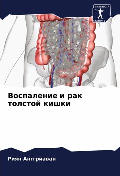 Vospalenie i rak tolstoj kishki Cover Vospalenie i rak tolstoj kishki