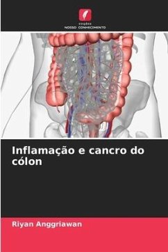 Inflamação e cancro do cólon - Anggriawan, Riyan